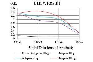Black line: Control Antigen (100 ng), Purple line: Antigen(10 ng), Blue line: Antigen (50 ng), Red line: Antigen (100 ng), (CD22 antibody  (AA 621-725))