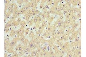 Immunohistochemistry of paraffin-embedded human liver tissue using ABIN7168635 at dilution of 1:100 (Sclerostin antibody  (AA 24-213))