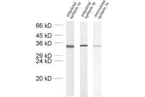 Syntaxin 1B antibody  (AA 171-187)