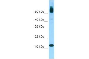 WB Suggested Anti-ACYP1 Antibody Titration: 1. (ACYP1 antibody  (Middle Region))