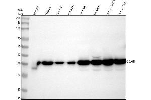 Western blot analysis of DDAH1 using anti-DDAH1 antibody (ABIN4886560). (DDAH1 antibody  (C-Term))