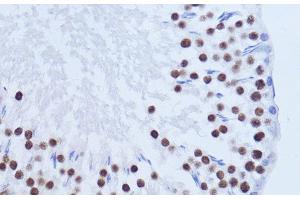 Immunohistochemistry of paraffin-embedded Rat testis using MATR3 Polyclonal Antibody at dilution of 1:100 (40x lens).