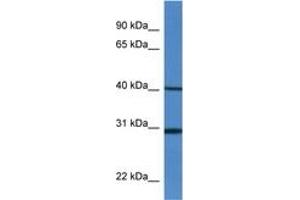 Image no. 1 for anti-Histocompatibility 13 (H13) (AA 240-289) antibody (ABIN6746312) (H13 antibody  (AA 240-289))