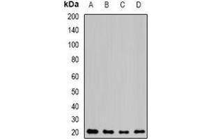 Western blot analysis of NAT5 expression in MCF7 (A), mouse kidney (B), mouse heart (C), rat lung (D) whole cell lysates.