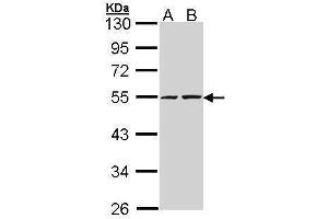 WB Image Sample (30 ug of whole cell lysate) A: A431 , B: H1299 10% SDS PAGE antibody diluted at 1:5000 (RUVBL2 antibody  (C-Term))