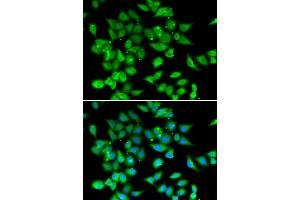 Immunofluorescence analysis of HeLa cell using NFATC3 antibody.
