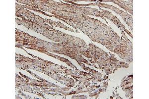 IHC analysis of LPP using anti-LPP antibody (ABIN7599606). (LPP antibody  (AA 10-572))