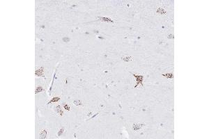 Immunohistochemical staining of human hippocampus with FAM3C polyclonal antibody  shows strong granular cytoplasmic positivity in neurons at 1:1000-1:2500 dilution.