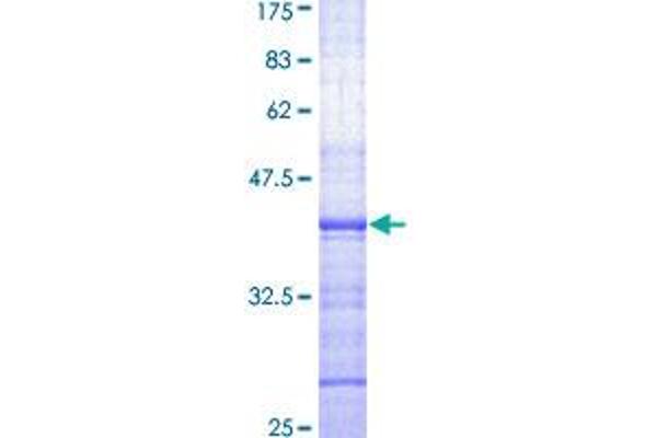 DDB2 Protein (AA 1-109) (GST tag)