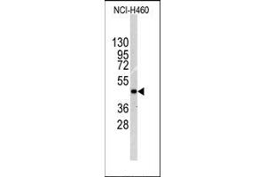 Image no. 1 for anti-Integrin-Linked Kinase (ILK) (Thr173) antibody (ABIN359883) (ILK antibody  (Thr173))