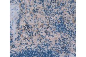Used in DAB staining on fromalin fixed paraffin- embedded Kidney tissue (WASP antibody  (AA 1-298))