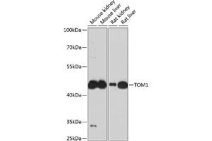 Western blot analysis of extracts of various cell lines, using TOM1 antibody (ABIN6128832, ABIN6149379, ABIN6149380 and ABIN6224955) at 1:3000 dilution. (TOM1 antibody  (AA 314-493))