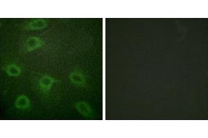 P-peptide - +Immunofluorescence analysis of HeLa cells, using BAD (Phospho-Ser134) antibody. (BAD antibody  (pSer134))