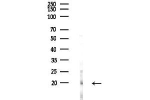 anti-Signal Recognition Particle 14kDa (Homologous Alu RNA Binding Protein) (SRP14) (Internal Region) antibody
