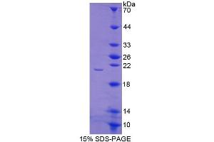 SDS-PAGE (SDS) image for Haptoglobin (HP) (AA 125-297) protein (His tag) (ABIN2121199) (Haptoglobin Protein (HP) (AA 125-297) (His tag))