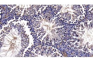 Immunohistochemistry (IHC) image for anti-Nuclear Factor-kB p65 (NFkBP65) (AA 19-306) antibody (ABIN7432211)