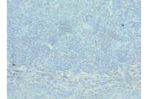 Immunohistochemistry of paraffin-embedded human tonsil tissue using ABIN7143075 at dilution of 1:100 (ACTR2 antibody  (AA 1-160))