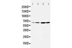 Anti-Dopamine Receptor D1 antibody, Western blotting Lane 1: Rat Testis Tissue Lysate Lane 2: Rat Brain Tissue Lysate Lane 3: U87 Cell Lysate Lane 4: HELA Cell Lysate (Dopamine Receptor d1 antibody  (Middle Region))