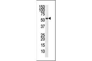 Western blot analysis of anti-M1F Pab (ABIN392883 and ABIN2842287) in mouse liver tissue lysate (35 μg/lane). (PPM1F antibody  (N-Term))