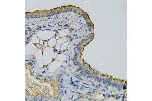 Immunohistochemistry of paraffin-embedded mouse lung using RPLP0 Antibody (ABIN6290910) at dilution of 1:100 (40x lens).