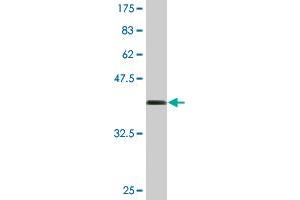 Western Blot detection against Immunogen (36. (MGAT3 antibody  (AA 430-531))
