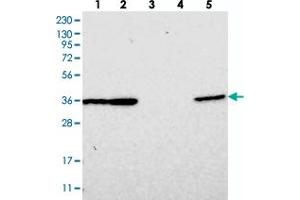Western blot analysis of Lane 1: RT-4, Lane 2: U-251 MG, Lane 3: Human Plasma, Lane 4: Liver, Lane 5: Tonsil with DNAJB14 polyclonal antibody  at 1:250-1:500 dilution.