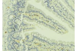 ABIN6279736 at 1/100 staining Mouse colon tissue by IHC-P. (RAB32 antibody  (C-Term))