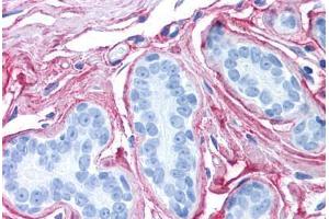 Human Breast (formalin-fixed, paraffin-embedded) stained with Collagen VI antibody ABIN364508 at 2. (COL6 antibody)