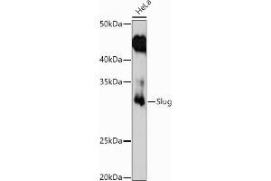 Western blot analysis of extracts of HeLa cells, using Slug antibody (ABIN3021317, ABIN3021318, ABIN3021319 and ABIN6214866) at 1:1000 dilution.