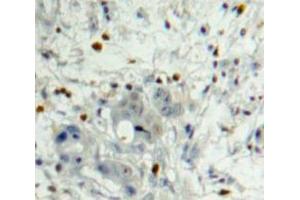Used in DAB staining on fromalin fixed paraffin-embedded Pancreas tissue (PDGFB antibody  (AA 21-241))