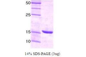 Figure annotation denotes ug of protein loaded and % gel used. (UBE2I Protein)