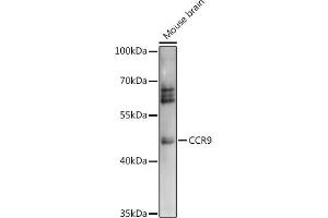 Western blot analysis of extracts of Mouse brain, using CCR9 antibody (ABIN7266312) at 1:1000 dilution. (CCR9 antibody  (AA 1-100))