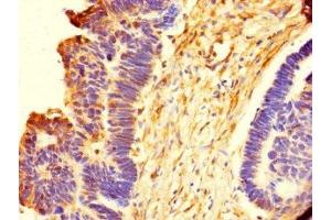 Immunohistochemistry of paraffin-embedded human ovarian tissue using ABIN7151610 at dilution of 1:100 (Emilin1 antibody  (AA 1-347))