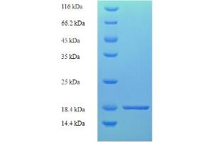 SDS-PAGE (SDS) image for Tight Junction Protein 1 (TJP1) (AA 1633-1769), (partial) protein (His tag) (ABIN5710500) (TJP1 Protein (AA 1633-1769, partial) (His tag))