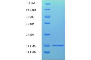 SDS-PAGE (SDS) image for Tight Junction Protein 1 (TJP1) (AA 1633-1769), (partial) protein (His tag) (ABIN5710500)