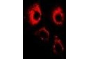 Immunofluorescent analysis of ADAM9 staining in U2OS cells. (ADAM9 antibody)