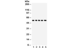 Western blot testing of 1) rat liver, 2) rat testis, 3) human HeLa, 4) RH35, and 5) HEPA lysate with SSH3BP1 antibody. (ABI1 antibody)