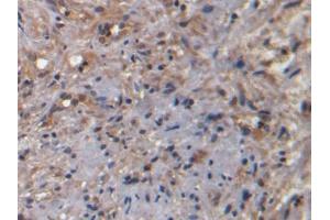 DAB staining on IHC-P; Samples: Human Prostate Tissue) (NKA antibody)