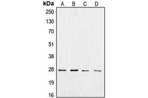 Western blot analysis of CK2 beta expression in HeLa (A), Jurkat (B), mouse brain (C), rat brain (D) whole cell lysates.
