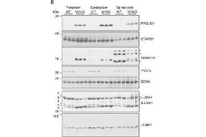 Defective proteostasis and accelerated OPA1 processing in brain and spinal cord of NYKO miceATEM analysis of sagittal spinal cord sections of 6- to 7-week-old WT and NYKO mice. (TIMM17A antibody  (C-Term))