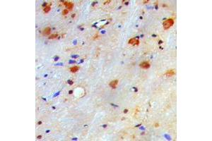 Immunohistochemical analysis of nm23-H1 staining in human brain formalin fixed paraffin embedded tissue section. (NME1 antibody  (Center))
