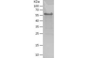 Western Blotting (WB) image for Melanoma Antigen Family D, 4 (MAGED4) (AA 1-350) protein (His-IF2DI Tag) (ABIN7283899) (Melanoma Antigen Family D, 4 (MAGED4) (AA 1-350) protein (His-IF2DI Tag))