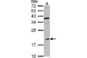 WB Image Sample(30 ug whole cell lysate) A:Raji , 12% SDS PAGE antibody diluted at 1:1000 (IFNA8 antibody)