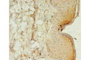 Immunohistochemistry of paraffin-embedded human skin tissue using ABIN7170464 at dilution of 1:100 (SPANXC antibody  (AA 1-97))
