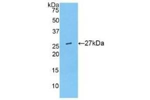Detection of Recombinant ANGPTL6, Mouse using Polyclonal Antibody to Angiopoietin Like Protein 6 (ANGPTL6) (ANGPTL6 antibody  (AA 238-457))
