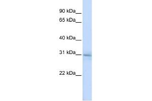 WB Suggested Anti-METTL5 Antibody Titration: 0. (METTL5 antibody  (N-Term))