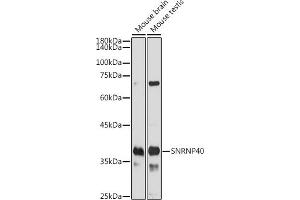 Western blot analysis of extracts of various cell lines, using SNRNP40 antibody (ABIN7270361) at 1:1000 dilution. (SNRNP40 antibody)