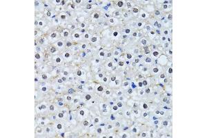Immunohistochemistry of paraffin-embedded mouse liver using HIST2H2BE antibody. (HIST2H2BE antibody)