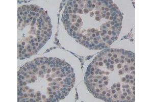 Used in DAB staining on fromalin fixed paraffin- embedded testis tissue (DOK1 antibody  (AA 18-237))