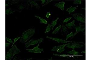 Immunofluorescence of monoclonal antibody to BRAF on HeLa cell. (BRAF antibody  (AA 138-231))
